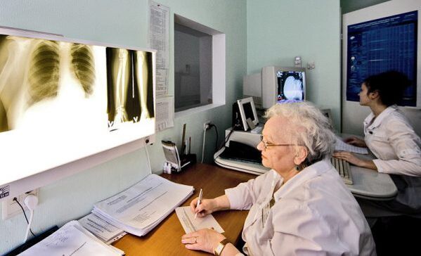 اشعه ایکس برای تشخیص کمردرد
