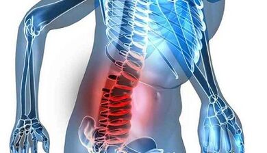 علائم و نشانه های پوکی استخوان کمری